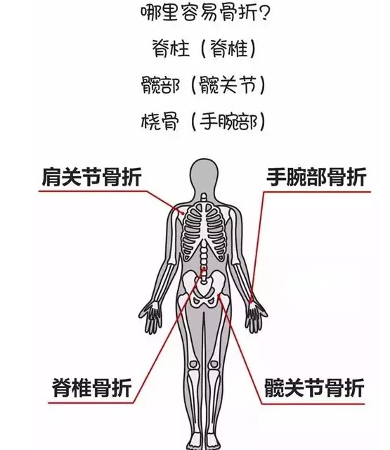 骨密度檢測儀